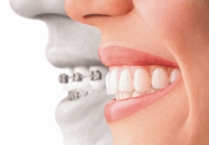 dental-clinic-fogszabalyzas_clearsmile-budapest