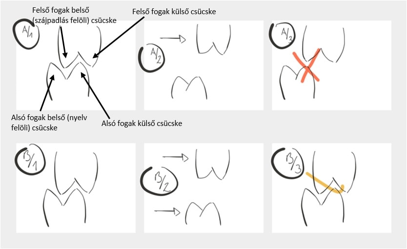 a fogal találkozása torlódás miatt