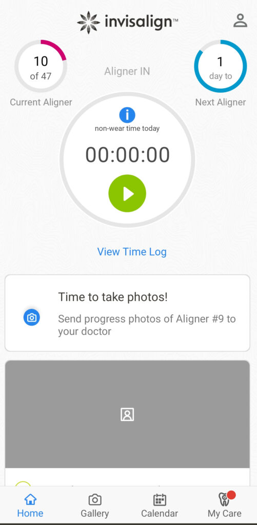 invisalign app főoldal